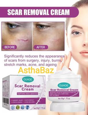 Ouhoe Scar Removing Cream (50g)_img_0