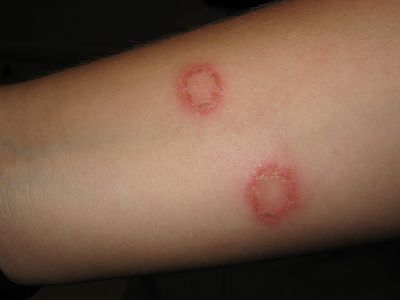 Ketofly Soap ( Indian)_img_5