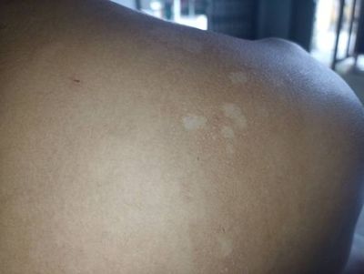 Ketofly Soap ( Indian)_img_11
