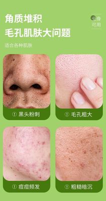 GINBI Aloe Vera Exfoliating Gel 100g/60g_img_3