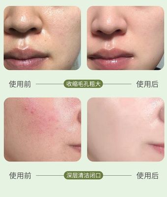 GINBI Aloe Vera Exfoliating Gel 100g/60g_img_5