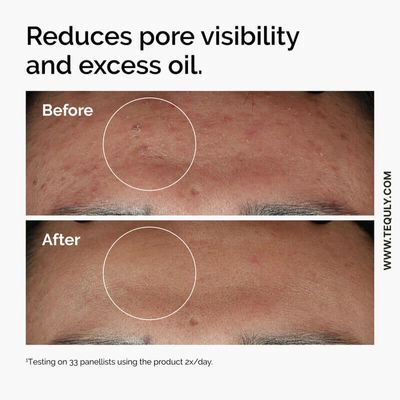 The Ordinary Niacinamide 10% + Zinc 1%_img_2