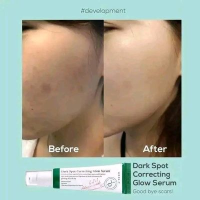 dark spot Mini serum 5_img_1