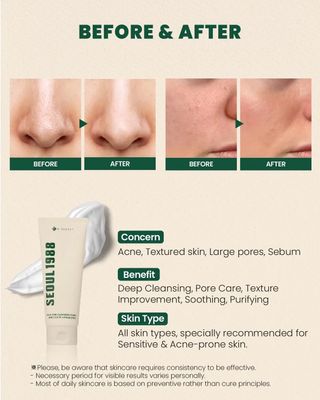 KSECRET SEOUL 1988 Cleansing Foam: Pine Cica 1% + Probiotics (150ml)_img_1