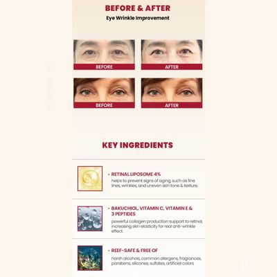 KSECRET SEOUL 1988 Eye Cream : Retinal Liposome 4% + Fermented Bean 30ml_img_4