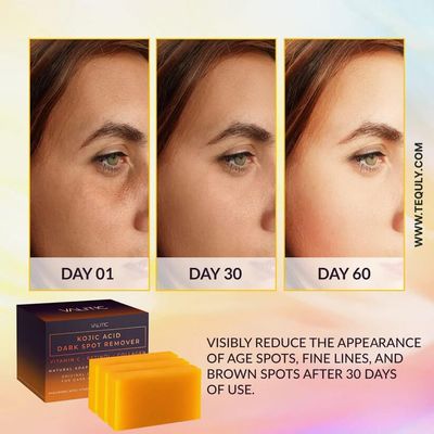 Kojic Acid Dark Spot Remover Soap – 3.5 Oz, with Vitamin C, Retinol, Collagen & Turmeric_img_1