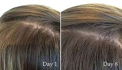 The Ordinary Multi-Peptide Serum for Hair Density_img_1