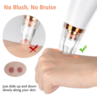 Multi-Functional Blackhead Vacuum - Face Cleaner_img_3