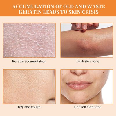 Orange Exfoliating Whitening Gel_img_7