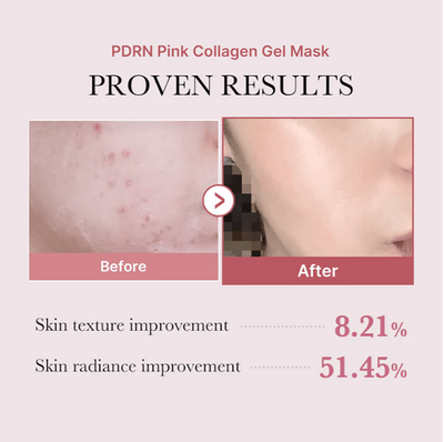 Medicube Salmon DNA PDRN Pink Collagen Gel Mask (28 gm)_img_4