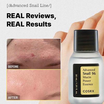 Buy COSRX Snail Mucin 96% Power Repairing Essence 30ml_img_1