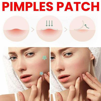 Pimple patches ✨_img_0