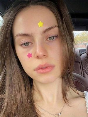 Pimple patches ✨_img_1