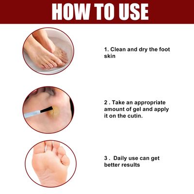South Moon™ Foot Corn Removal Extra Strengthen_img_1