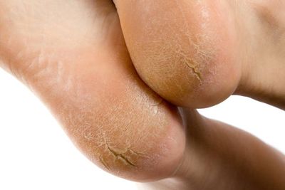 Foot Mark Cream 2 pcs [Indian]_img_6