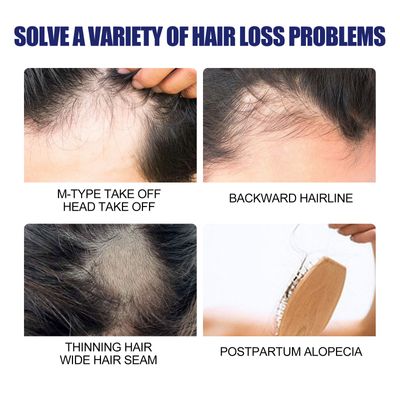 East Moon Hair Growth Foam Hair Deep Repair Roots Hair Follicles Thick Moisturizing Care 60g._img_5