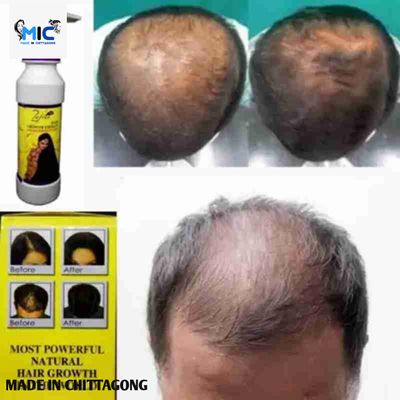 Zafran Hair Growth Therapy (oil) - 150ml - 00424_img_1