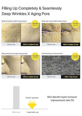 Celimax The Vita A Retinal Shot Tightening Booster | Pore Minimizer, Wrinkles & Fine Lines, Firmer Skin, 15ml_img_3