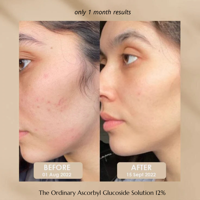 The Ordinary Ascorbyl Glucoside Solution 12%_img_3
