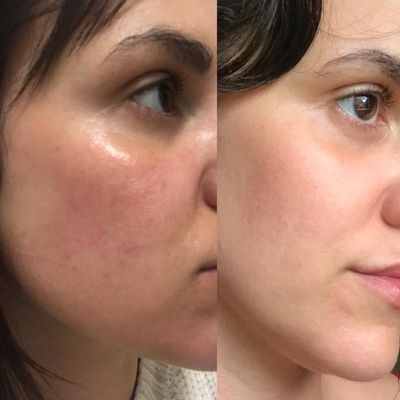 The Ordinary Ascorbyl Glucoside Solution 12%_img_5