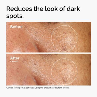 The Abnormal Beauty Company The Ordinary Alpha Arbutin 2 % + Ha 30 ml_img_3