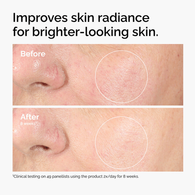 The Abnormal Beauty Company The Ordinary Alpha Arbutin 2 % + Ha 30 ml_img_4