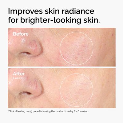 The Abnormal Beauty Company The Ordinary Alpha Arbutin 2 % + Ha 30 ml_img_5