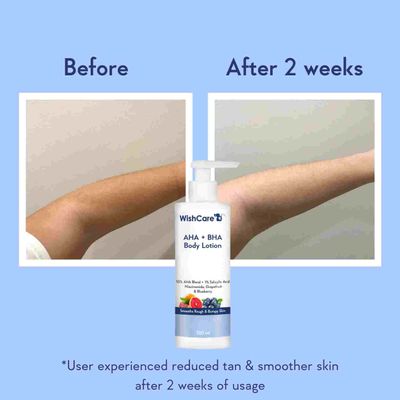 WishCare AHA + BHA Body Lotion_img_3