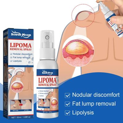 South Moon - Lipoma Remover Spray Relief Lipolysis Fat Lump With Lipoma Spray 50 ml_img_0
