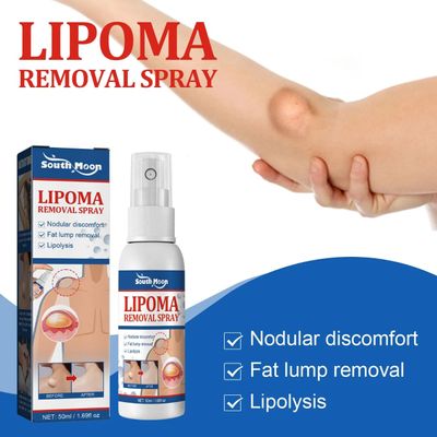 South Moon - Lipoma Remover Spray Relief Lipolysis Fat Lump With Lipoma Spray 50 ml_img_7