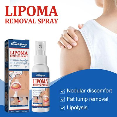 South Moon - Lipoma Remover Spray Relief Lipolysis Fat Lump With Lipoma Spray 50 ml_img_8