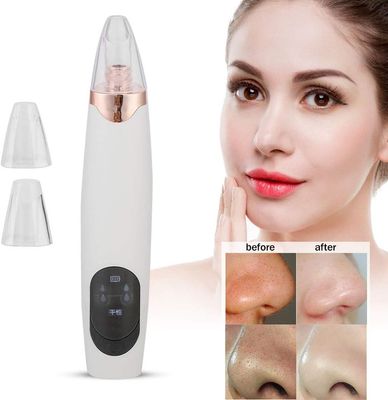 Electric Face Suction Removal Machine Men & Women Pore Cleaner black Head Vacuum Pimple Black Head Remover Beauty Device_img_0