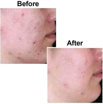Kojic san soap_img_1