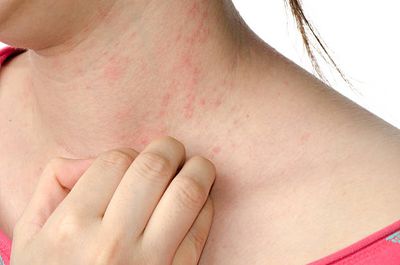 Permimite Lotion [Indian] চুলকানি ধ্বংসকারী এবং উকুননাশক_img_4