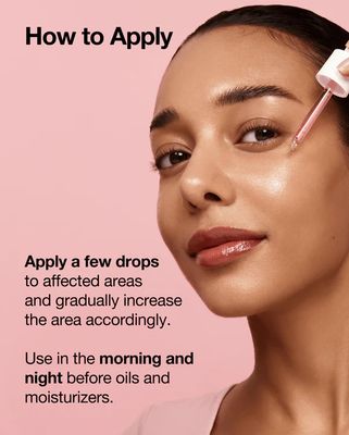 Anua Niacinamide 10% + TXA 4% Serum – 30ml_img_5