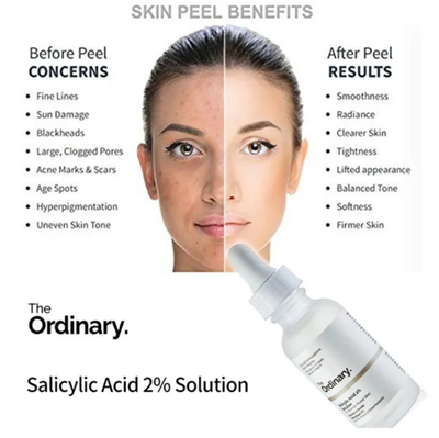 The Ordinary Salicylic Acid 2% Solution_img_2