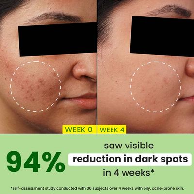 Dot & Key Cica + 10% Niacinamide Face Serum for Oily Skin_img_1