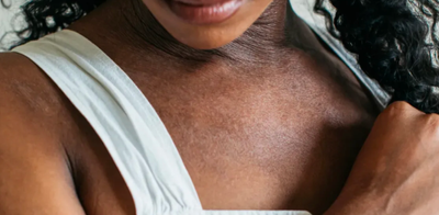 Clop G Cream [ একজিমা, দাগ চিকিৎসায় ]_img_4