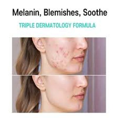 Care:Nel Anti-Melasma Cica Cream_img_3