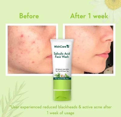 WishCare 2% Salicylic Acid with AHA, GreenTea, & TeaTree For Oliy Skin & Acne- Face Wash - 100 ml_img_3