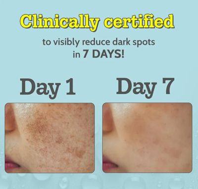 Chemist at Play 10% Vitamin C Face Serum 30ml_img_2