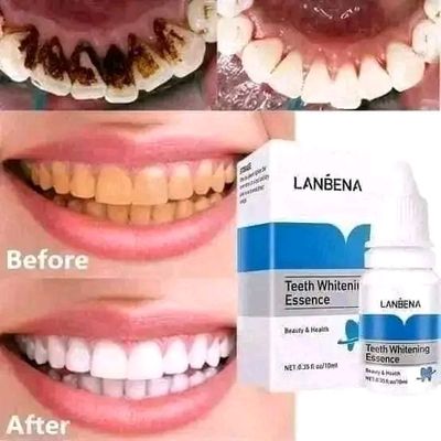 Lanbena Teeth Whitening Essence 10ml_img_3