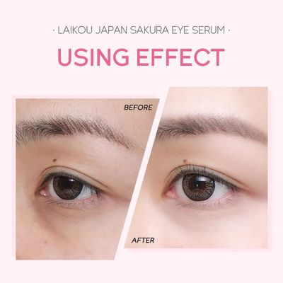 Sakura Eye Serum (15ml)_img_3