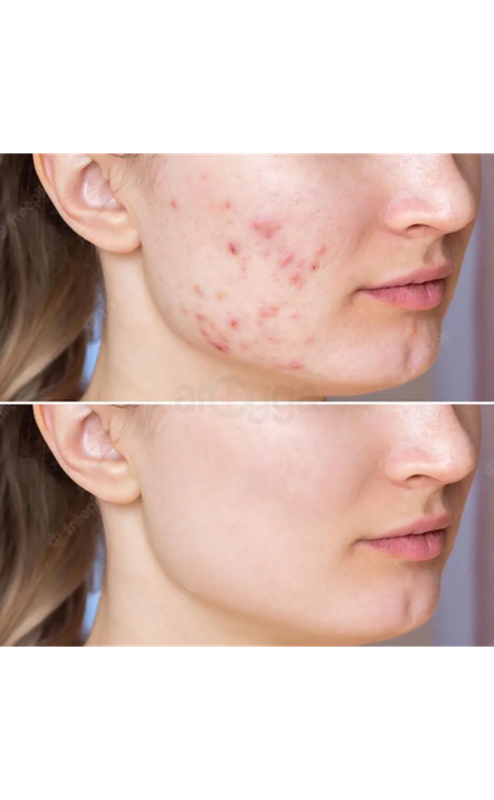 Earth Beauty & You Cica care + Barrier Repair Toner Anti-Acne Derma Solution 220ml - Image 4