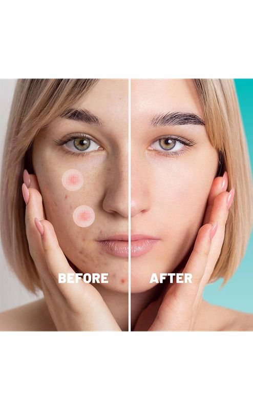 Earth Beauty & You Cica care+ Barrier Repair Acne Treatment Serum - Image 4