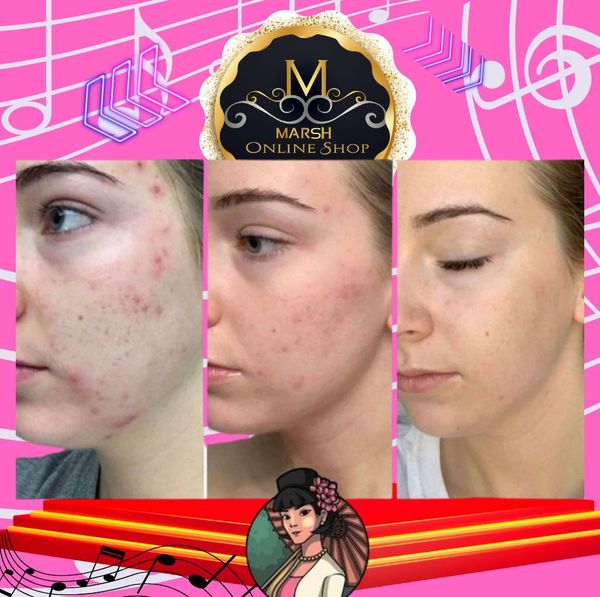 🔰Shwe Pyi Nann Whitening Thanakha Pudding Face Cream(25ml) - Image 3