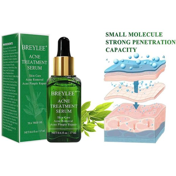 Breylee Acne Treatment Serum