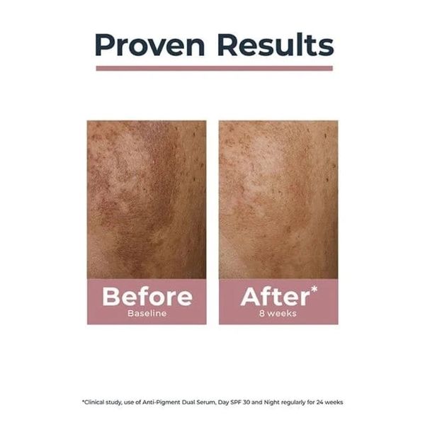 Eucerin Spotless Brightening Boosting Essence - Image 3