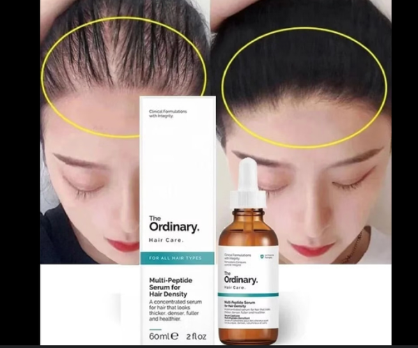 The Ordinary Hair Care Multi-Peptide Serum - Image 4