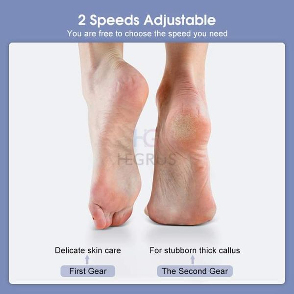 💥HEGRUS Rechargeable Electric Foot Grinder with 2 Grinding Heads - Image 8